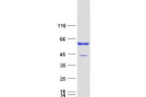 Validation with Western Blot
