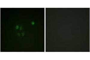 Immunofluorescence analysis of A549 cells, using Chk1 (Ab-301) Antibody. (CHEK1 anticorps  (AA 271-320))