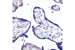 Immunohistochemistry of paraffin-embedded human placenta using JAM-A/CD321/F11R Rabbit pAb (ABIN3021822, ABIN3021823, ABIN3021824, ABIN1512881 and ABIN6216028) at dilution of 1:100 (40x lens). (F11R anticorps  (AA 30-238))