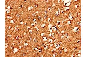 Immunohistochemistry of paraffin-embedded human brain tissue using ABIN7154668 at dilution of 1:100 (GNG11 anticorps  (AA 1-70))