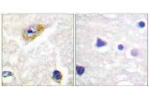 Immunohistochemistry (IHC) image for anti-CaMK2 alpha/beta/delta (pThr305), (Thr305) antibody (ABIN1847206)