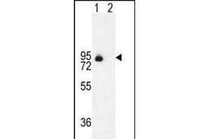Western blot analysis of ENG (arrow) using rabbit polyclonal ENG Antibody (Center) (ABIN655186 and ABIN2844801). (Endoglin anticorps  (AA 265-294))