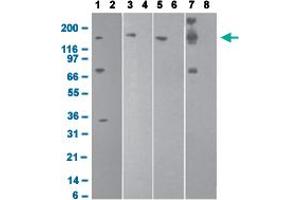 Western blot analysis with DNMT1 monoclonal antibody, clone 60B1220. (DNMT1 anticorps  (AA 637-650))