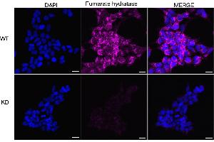 Immunocytochemical staining of HeLa cells using Fumarate hydratase antibody (ABIN7798665), 1:1,000), Top panel: wild-type (WT), Bottom panal: Fumarate hydratase shRNA knockdown (KD). (FH anticorps)