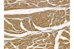 ABIN6257400 and ABIN6273967 at 1/100 staining human tongue carcinoma by IHC-P. (OR1G1 anticorps  (Internal Region))