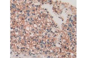 Used in DAB staining on fromalin fixed paraffin- embedded kidney cancer tissue (SPRY3 anticorps  (AA 91-288))