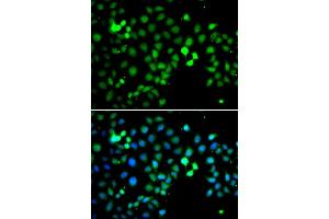 Immunofluorescence analysis of A549 cell using MTF2 antibody. (MTF2 anticorps)