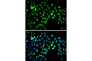 Immunofluorescence analysis of A549 cell using MTF2 antibody. (MTF2 anticorps)