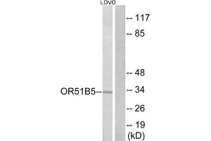 Western blot analysis of extracts from LOVO cells, using OR51B5 antibody. (OR51B5 anticorps  (Internal Region))