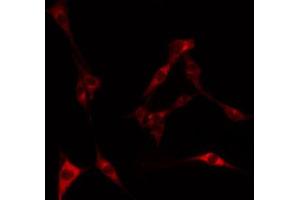 ABIN6269372 staining HeLa by IF/ICC. (LKB1 anticorps  (Internal Region))