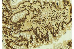 ABIN6273604 at 1/100 staining Mouse colon tissue by IHC-P. (ZNF71 anticorps)