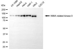 Western blotting analysis using NIMA related kinase 9 antibody (ABIN7799601).