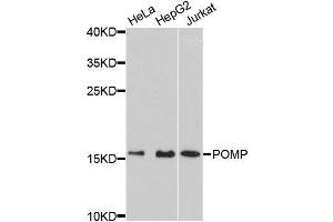 Western blot analysis of extracts of various cell lines, using POMP antibody (ABIN5996666) at 1:3000 dilution. (POMP anticorps)