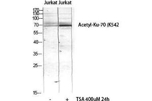 Western Blot (WB) analysis of JK lysis using Acetyl-Ku-70 (K542) antibody. (XRCC6 anticorps  (acLys542))