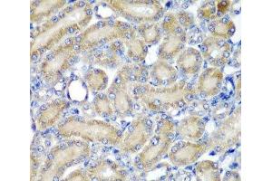 Immunohistochemistry of paraffin-embedded Rat kidney using PDCD6 Polyclonal Antibody at dilution of 1:200 (40x lens).