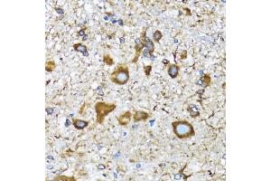 Immunohistochemistry of paraffin-embedded mouse spinal cord using MLC3A antibody (ABIN6134219, ABIN6143466, ABIN6143468 and ABIN6215215) at dilution of 1:100 (40x lens). (MAP1LC3A anticorps  (AA 1-100))