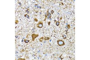 Immunohistochemistry of paraffin-embedded mouse spinal cord using MLC3A antibody (ABIN6134219, ABIN6143466, ABIN6143468 and ABIN6215215) at dilution of 1:100 (40x lens).
