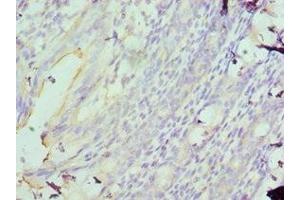 Immunohistochemistry of paraffin-embedded human colon using ABIN7160089 at dilution of 1:100 (MAD2L1 anticorps  (AA 1-205))