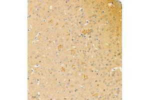 Immunohistochemistry of paraffin embedded mouse brain using phospho-TAU (S202/T205) (ABIN7075838) at dilution of 1: 1200