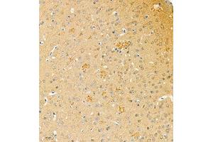 Immunohistochemistry of paraffin embedded mouse brain using phospho-TAU (S202/T205) (ABIN7075838) at dilution of 1: 1200 (tau anticorps  (pSer202, pThr205))