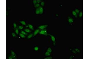 Immunofluorescent analysis of HepG2 cells using ABIN7149476 at dilution of 1:100 and Alexa Fluor 488-congugated AffiniPure Goat Anti-Rabbit IgG(H+L)