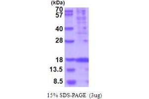 SDS-PAGE (SDS) image for Thymic Stromal Lymphopoietin (TSLP) (AA 29-159) protein (His tag) (ABIN6387542) (Thymic Stromal Lymphopoietin Protein (TSLP) (AA 29-159) (His tag))