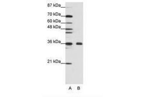 Image no. 2 for anti-Fibrillarin (FBL) (AA 61-110) antibody (ABIN307418) (Fibrillarin anticorps  (AA 61-110))