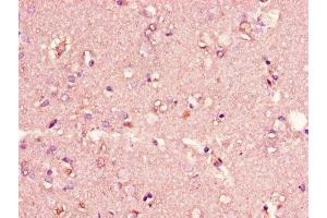 Immunohistochemistry of paraffin-embedded human brain tissue using ABIN7147273 at dilution of 1:100