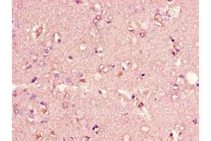 Immunohistochemistry of paraffin-embedded human brain tissue using ABIN7147273 at dilution of 1:100 (CIDEA anticorps  (AA 1-51))