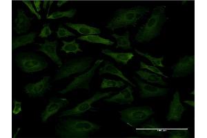 Immunofluorescence of monoclonal antibody to PKLR on HeLa cell. (PKLR anticorps  (AA 485-574))