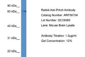 Western Blotting (WB) image for anti-Protein Kinase C, eta (PRKCH) (C-Term) antibody (ABIN2786853) (PKC eta anticorps  (C-Term))