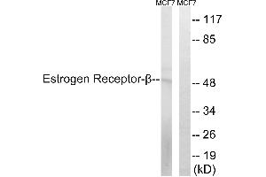 Western blot analysis of extracts from MCF-7 cells, using Estrogen Receptor-β (Ab-87) antibody.