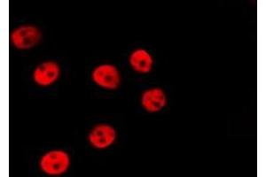 ABIN6277204 staining HepG2 by IF/ICC. (Histone 3 anticorps  (H3K79me))