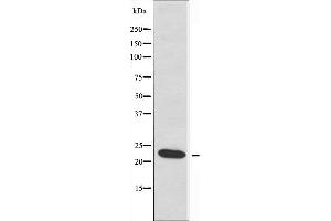 Western blot analysis of extracts from HeLa cells, using RPL17 antibody. (RPL17 anticorps  (C-Term))