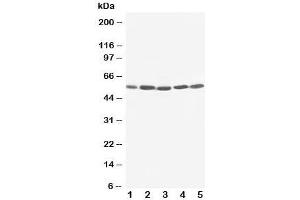 Western blot testing of KIM-1 antibody and Lane 1:  SMMC-7721;  2: HeLa;  3: PANC;  4: M231;  5: M453 cell lysate. (HAVCR1 anticorps  (C-Term))