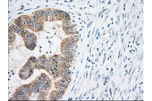 Immunohistochemical staining of paraffin-embedded Human Kidney tissue using anti-EIF2S1 mouse monoclonal antibody. (EIF2S1 anticorps)