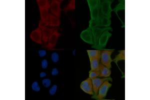 ABIN6264741 and ABIN6274043 staining Hela cells(24h of starvation treatment) by IF/ICC. (RhoA,B,C (C-Term) anticorps)