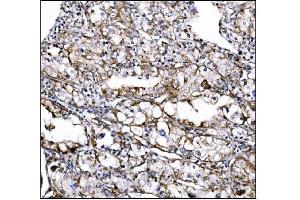 IHC analysis of DLGAP1 using anti-DLGAP1 antibody (ABIN7600257). (DLGAP1 anticorps  (AA 17-319))