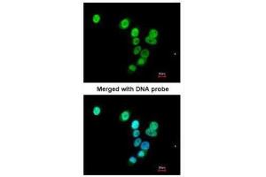 anti-RAS Protein Activator Like 1 (GAP1 Like) (RASAL1) (C-Term) antibody