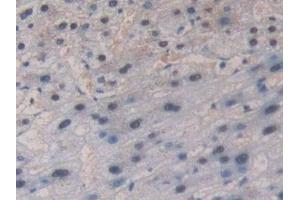 Detection of GR in Human Liver Tissue using Polyclonal Antibody to Glutathione Reductase (GR)