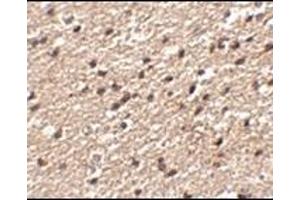 Immunohistochemistry of Stk39 in human brain tissue with this product at 2.