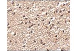 Immunohistochemistry of Stk39 in human brain tissue with this product at 2. (STK39 anticorps  (C-Term))