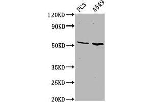 Western Blot Positive WB detected in: PC-3 whole cell lysate, A549 whole cell lysate All lanes: ETV5 antibody at 4. (ETV5 anticorps  (AA 124-265))