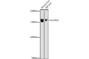 Western blot analysis of extracts of various cell lines, using NUP153 antibody (ABIN6133840, ABIN6144952 and ABIN7101835) at 1:1000 dilution. (NUP153 anticorps)
