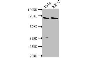Western Blot Positive WB detected in: Hela whole cell lysate, MCF-7 whole cell lysate All lanes: TTC39B antibody at 1:2000 Secondary Goat polyclonal to rabbit IgG at 1/50000 dilution Predicted band size: 77, 67, 76, 60, 70, 23 kDa Observed band size: 77 kDa (TTC39B anticorps  (AA 10-122))
