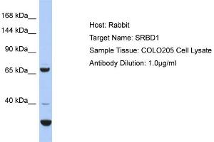 Host: Rabbit Target Name: SRBD1 Sample Type: COLO205 Whole Cell lysates Antibody Dilution: 1. (SRBD1 anticorps  (C-Term))