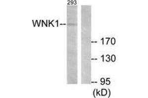 Western blot analysis of extracts from 293 cells, treated with EGF 200ng/ml 30', using WNK1 (Ab-58) Antibody. (WNK1 anticorps  (AA 24-73))