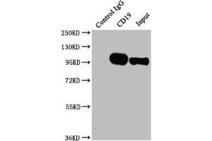 Immunoprecipitating CD19 in Raji whole cell lysate Lane 1: Rabbit control IgG instead of ABIN7127396 in Raji whole cell lysate.