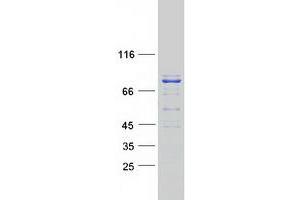 Validation with Western Blot