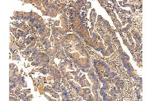 anti-Tctex1 Domain Containing 2 (TCTEX1D2) (C-Term) antibody